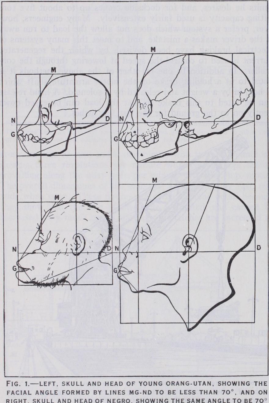 Craniometry