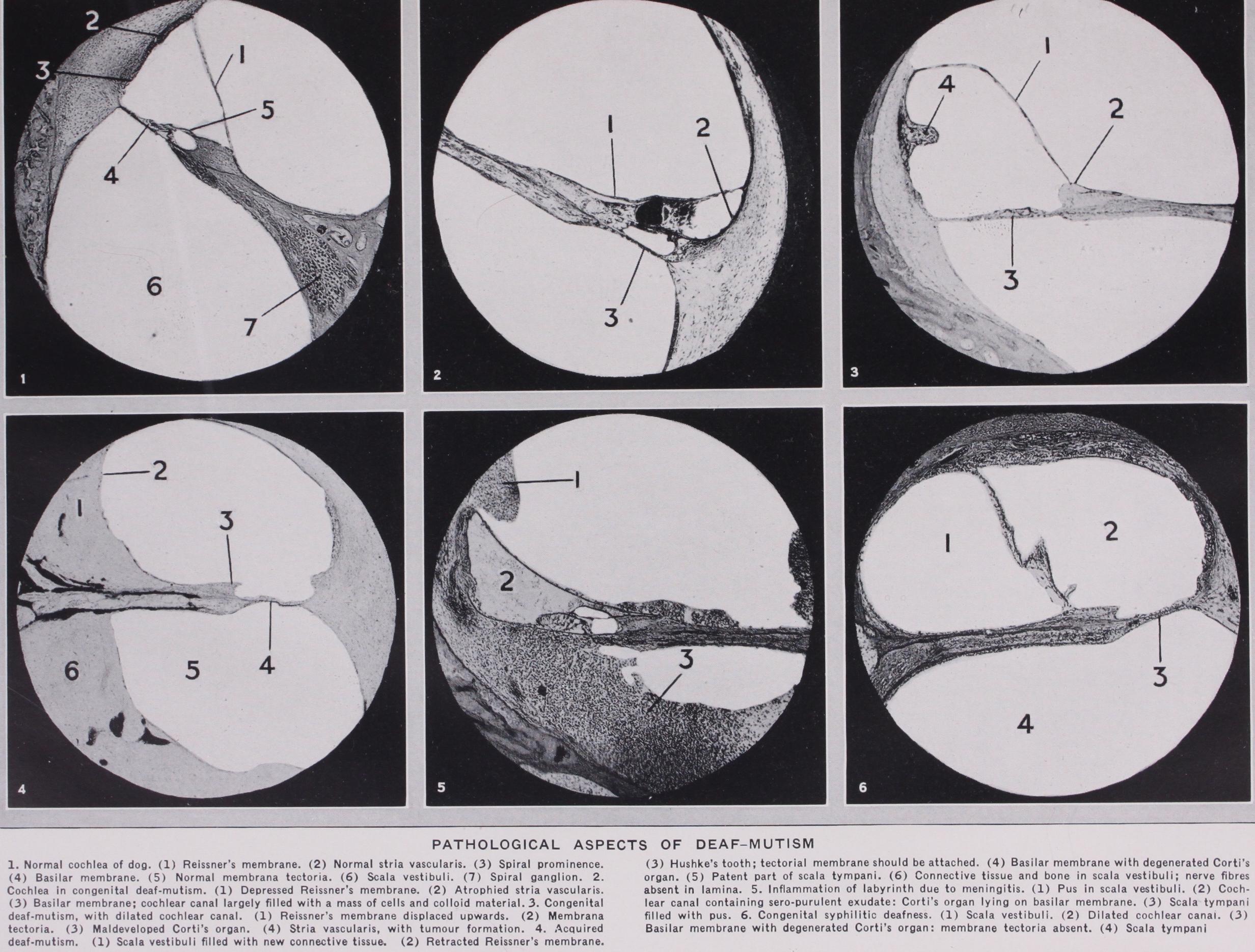 Medical Aspects of Deaf-Mutism